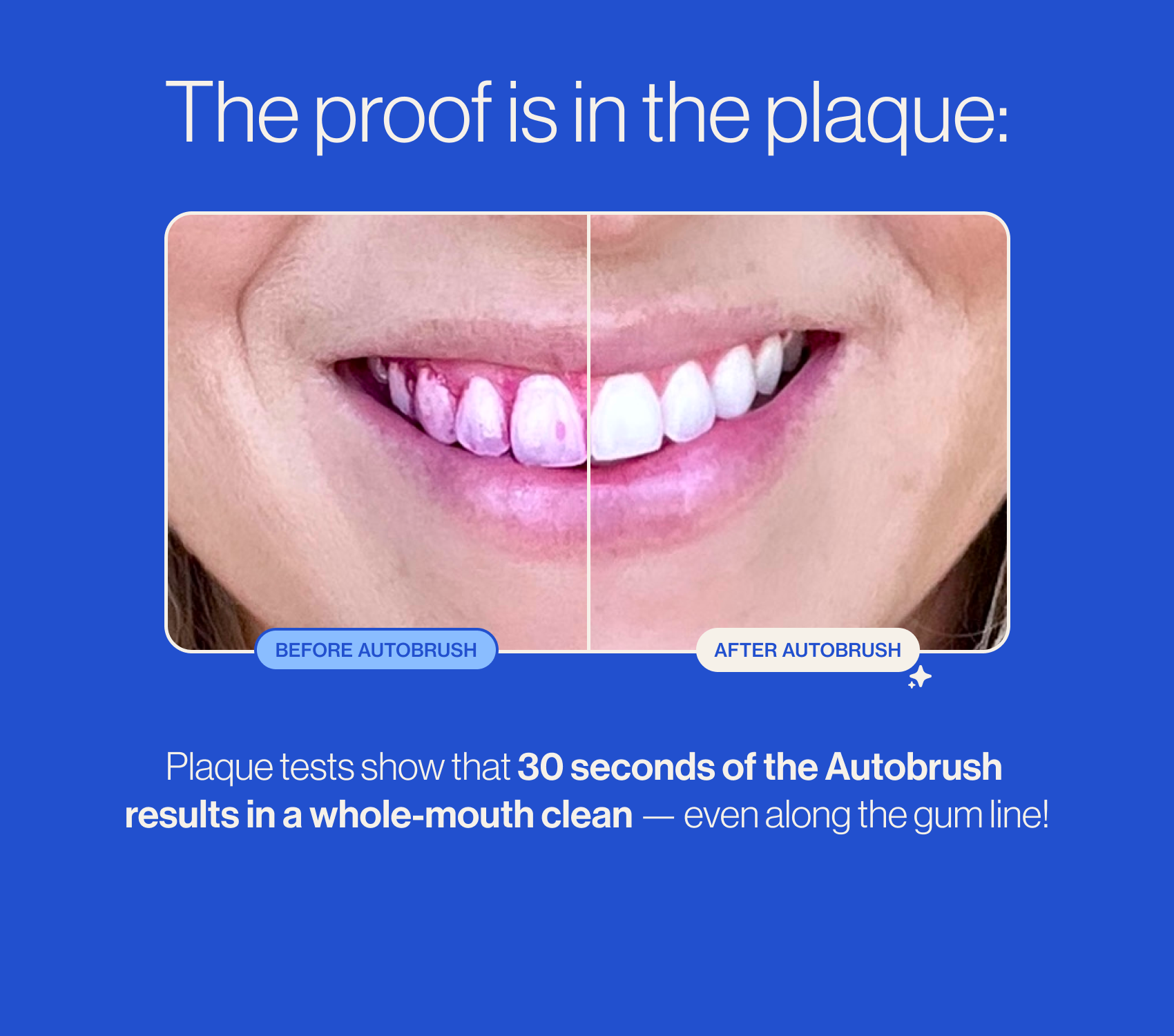 Auto ProBrush