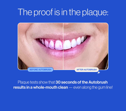 Auto ProBrush
